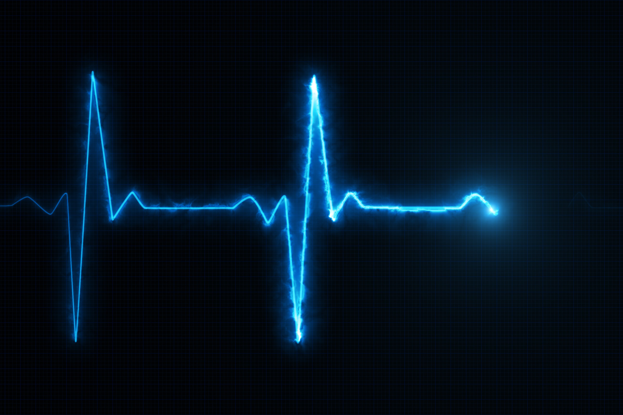 Electromyogram: Everything You Need to Know About Evaluating Your Pain